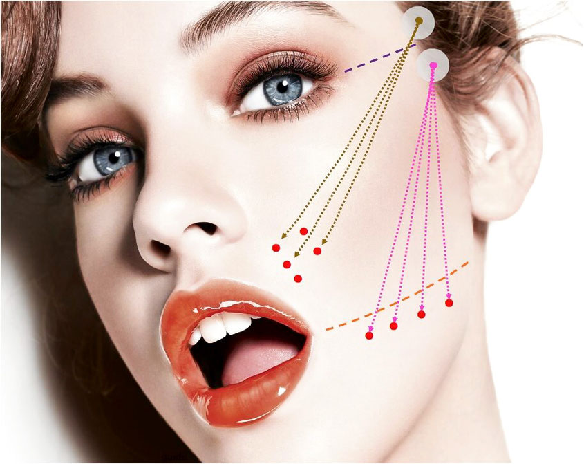 Was ist ein PDO Fadenlifting und braucht man das überhaupt? Meine Erfahrungen mit diesem minimal invasivem Facelift könnt Ihr auf Hot Port Life & Style nachlesen | Lifestyle Blog für Frauen um die 30