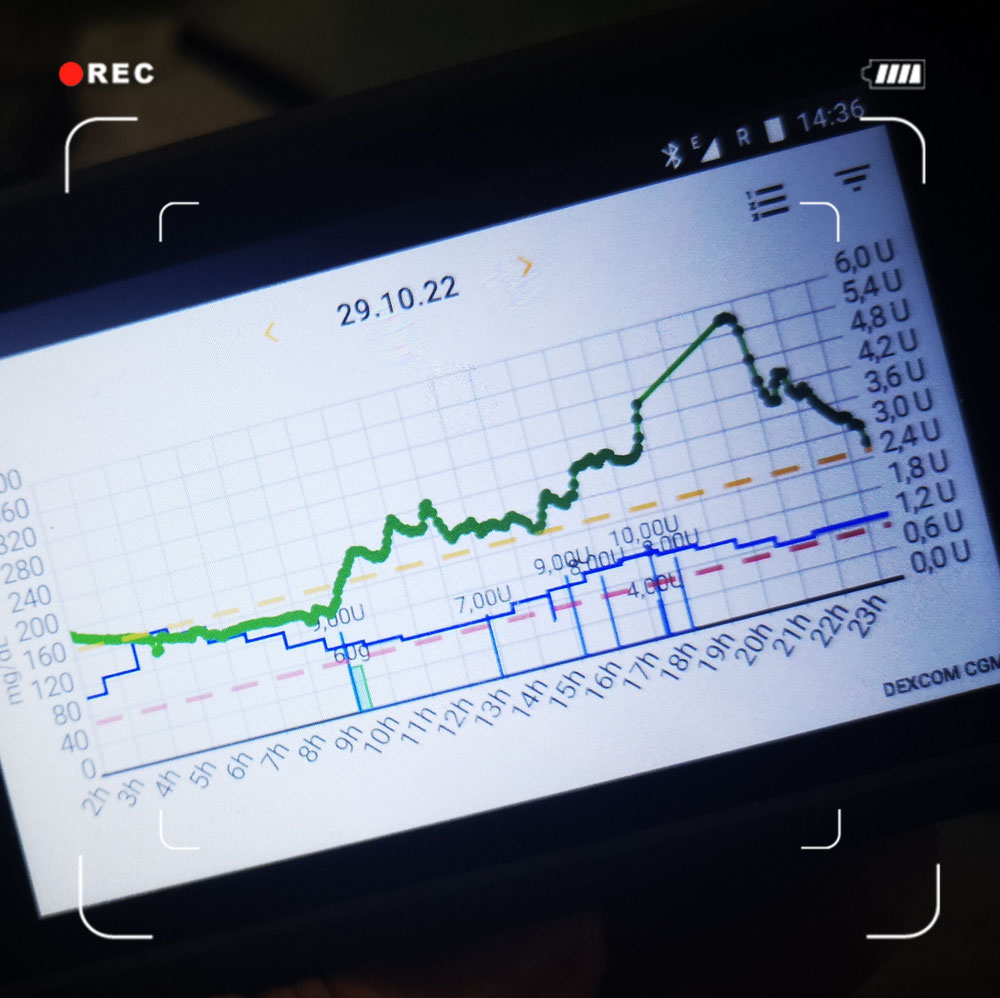 Loop aus, TBR 160%, Faktoren 2-2-2,5, abends erhöhe ich noch, wenn es so bleibt