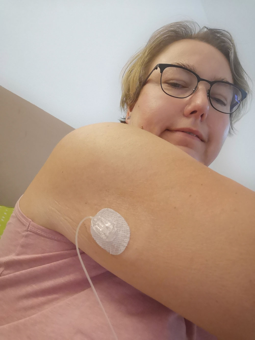 Auch am Arm nutze ich gerne Teflon, da diese mit einer Setzhilfe gesetzt werden. Das ist an der Stelle einfach praktischer. Am Arm nehme ich ebenfalls 6mm.