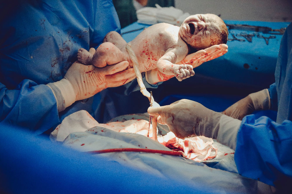 Egal ob Notkaiserschnitt oder vaginale Geburt, jedes dieser Erlebnis kann individuell als verletzten empfunden werden