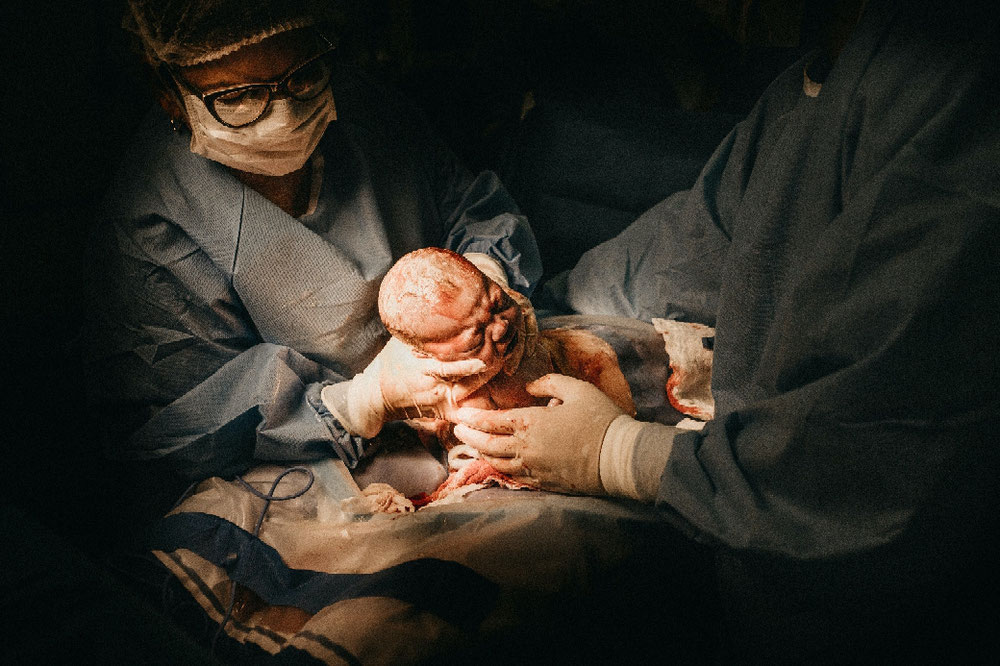 Ein ungeplanter Notkaiserschnitt kann enorm traumatisch für die ganze Familie sein