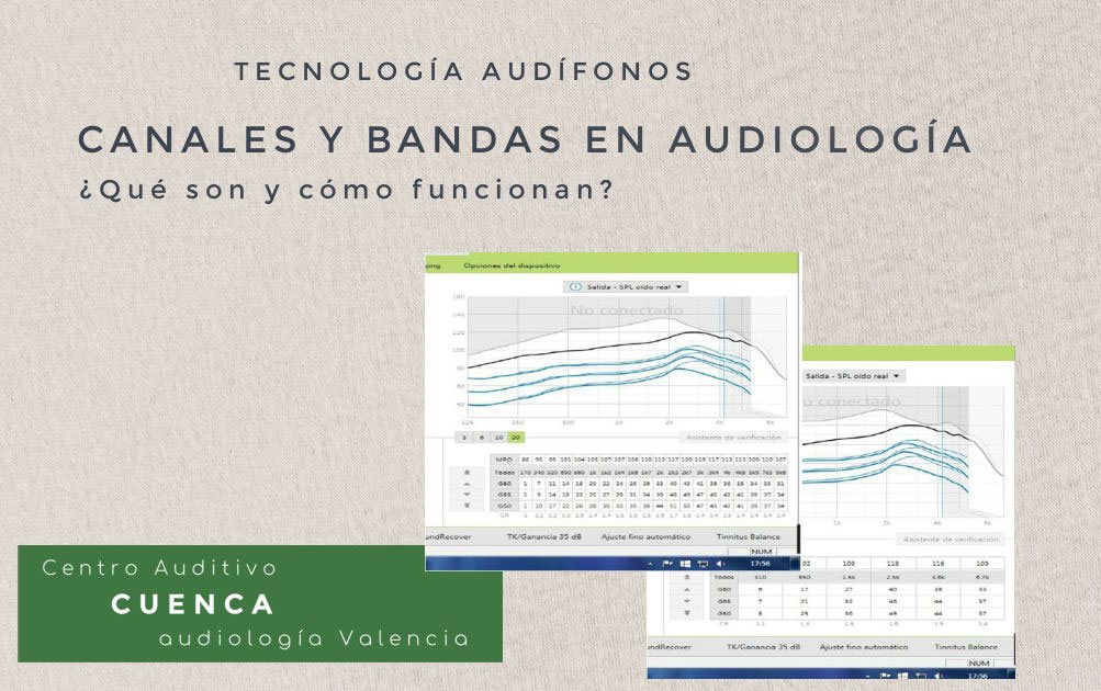 Los canales y bandas de los audífonos digitales. ¿Cómo influyen en la calidad del audífono?