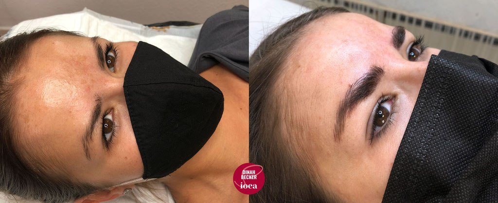 Microblading zum Auffüllen der Härchen