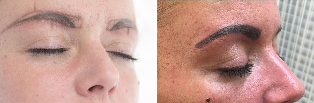 Kundin mit altem Tattoo, darüber Microblading (Schattiert) zur neuen Formgebung (Härchenzeichnung hier nicht möglich)