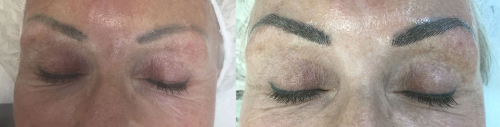 Kundin mit altem Tattoo, darüber Microblading