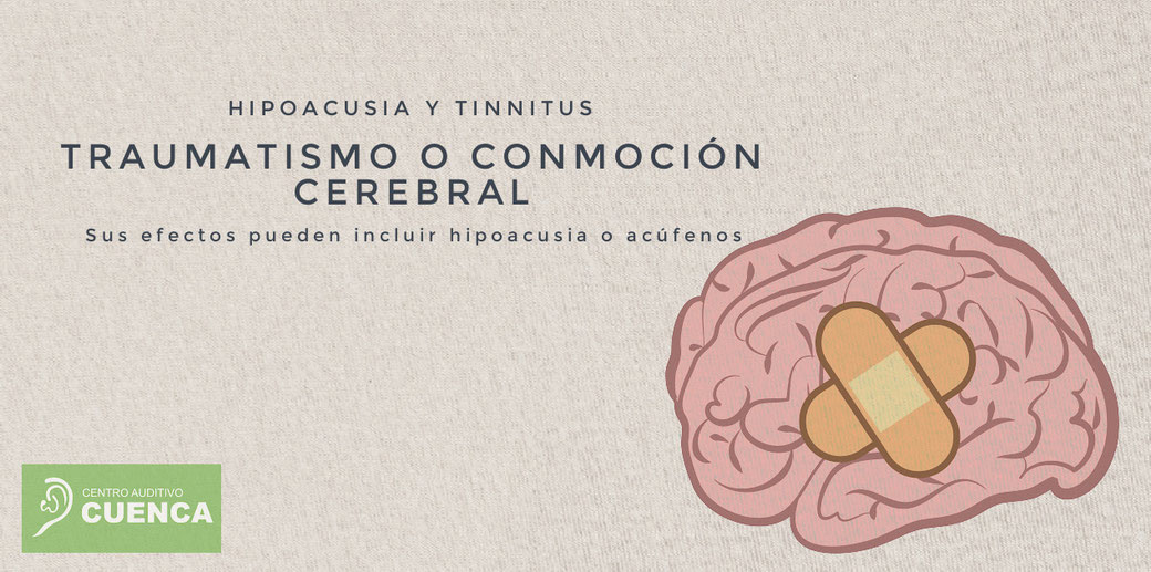 Los efectos de una conmoción o lesión por trauma cerebral pueden incluir pérdida auditiva o tinnitus. Centro Auditivo Cuenca.