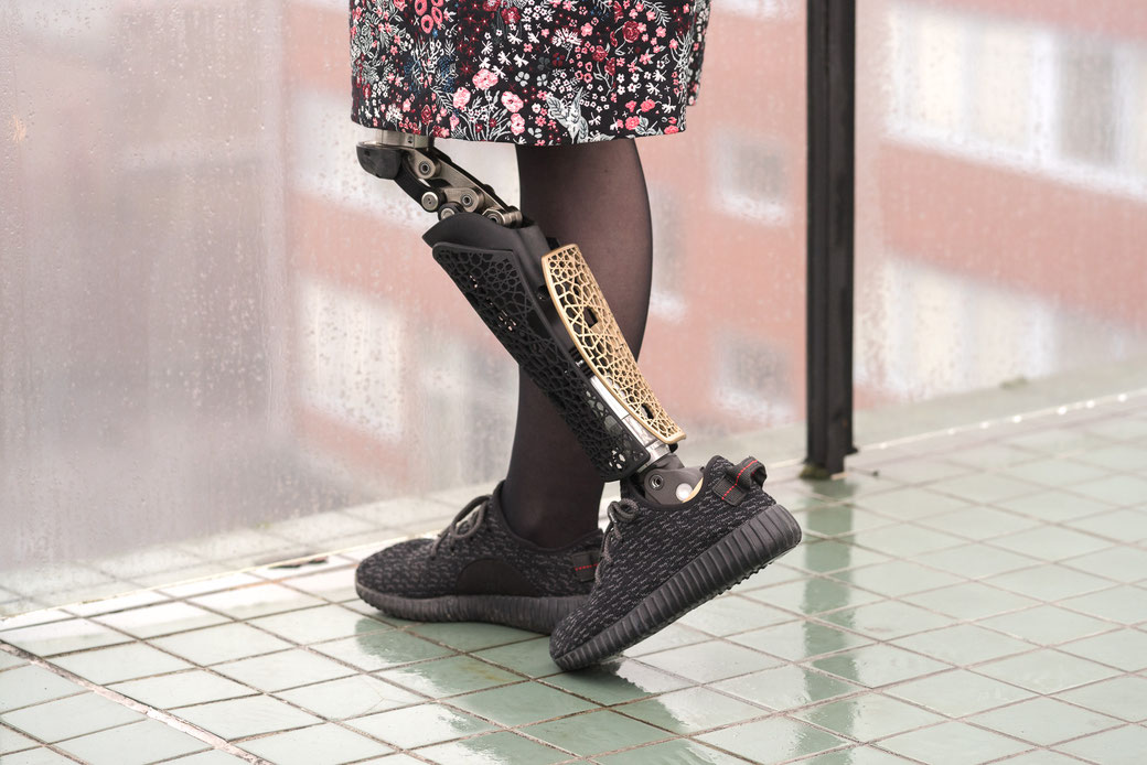 A cover is a great way to add individuality to an artificial limb (picture courtesy of Anatomic Studios)