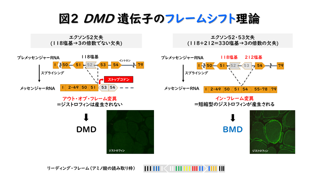 図2 DMD遺伝子のフレームシフト理論