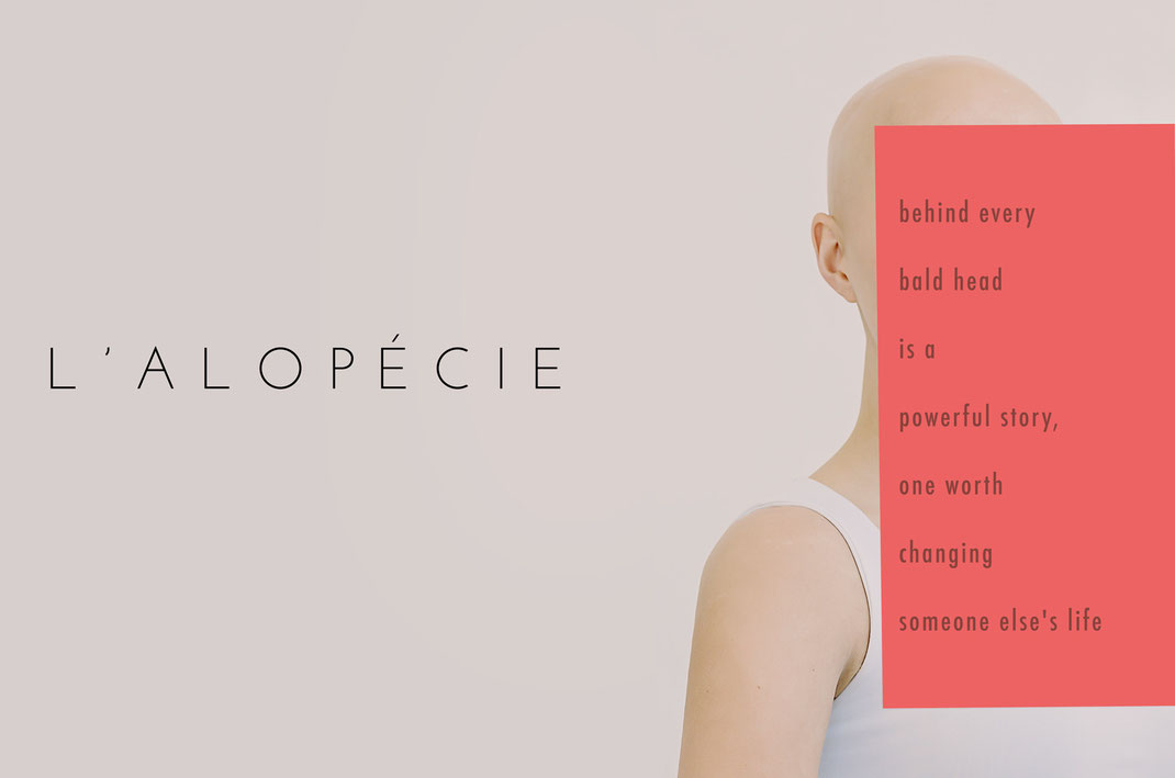 alopecie alopecia