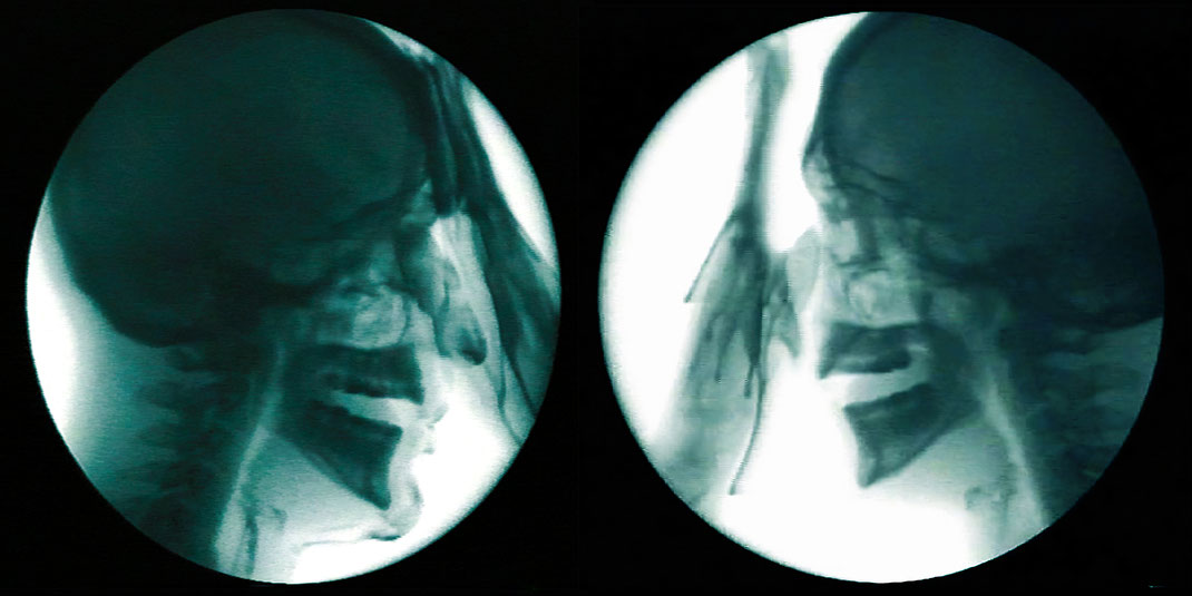medizinische-bildgebung-in-der-gegenwartskunst-x-ray-fluoroskopie-echtzeit-röntgen-video-selbstportrait-eines-kuenstlers