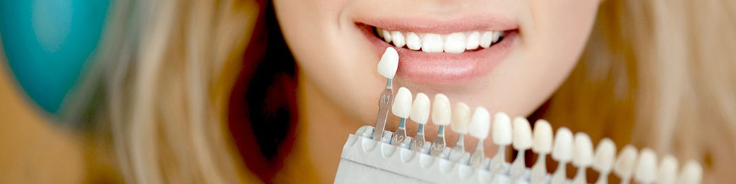 Zahnkrone Stuttgart Zahnarzt D Schulz