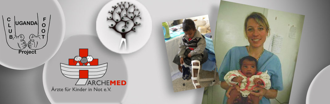 Die Charity-Organisation Archemed engagiert sich weltweit für die Klumpfußbehandlung nach Ponseti