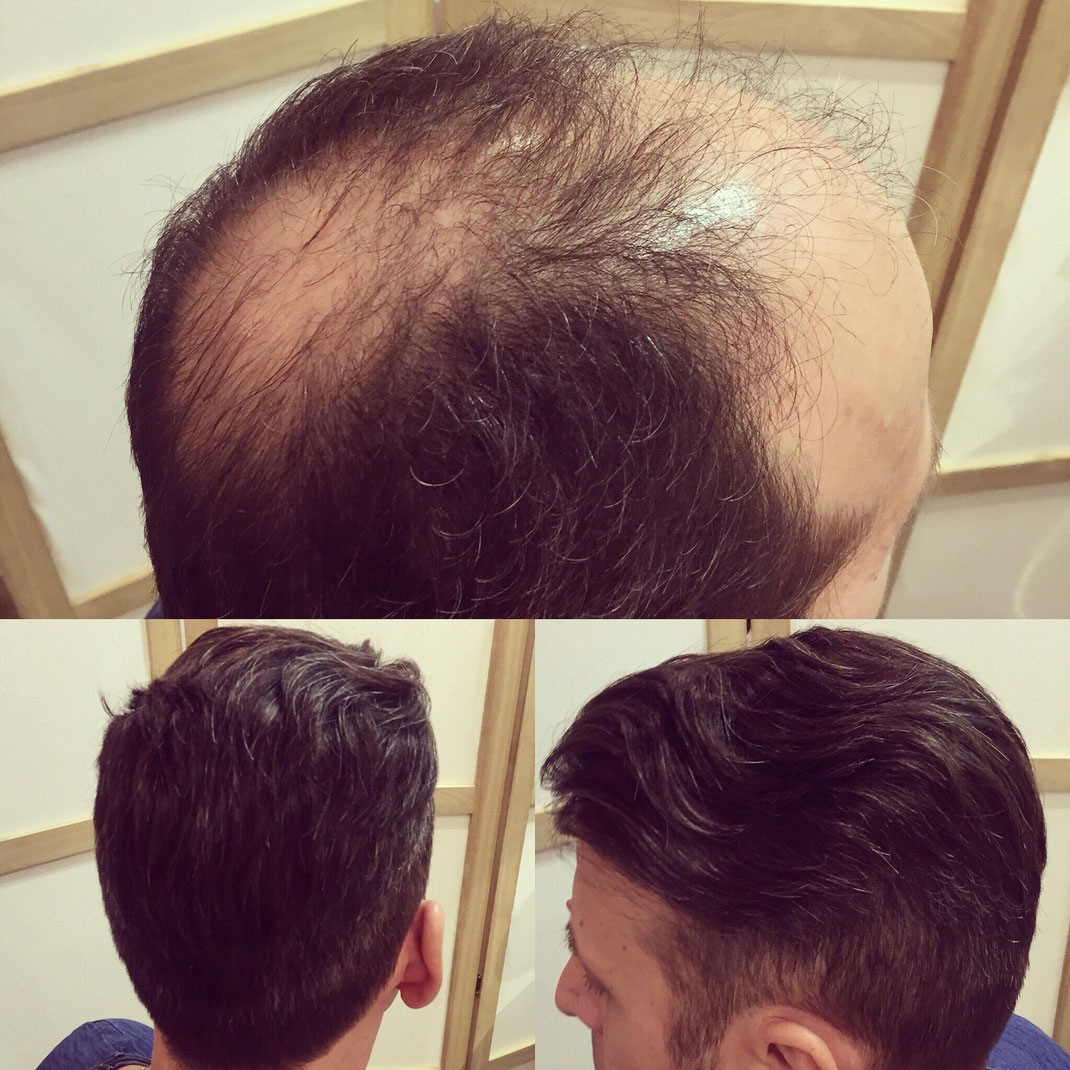 moumoute cheveux