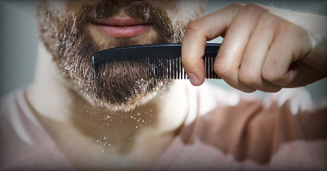 ¿Necesitas detener la caspa de tu barba?