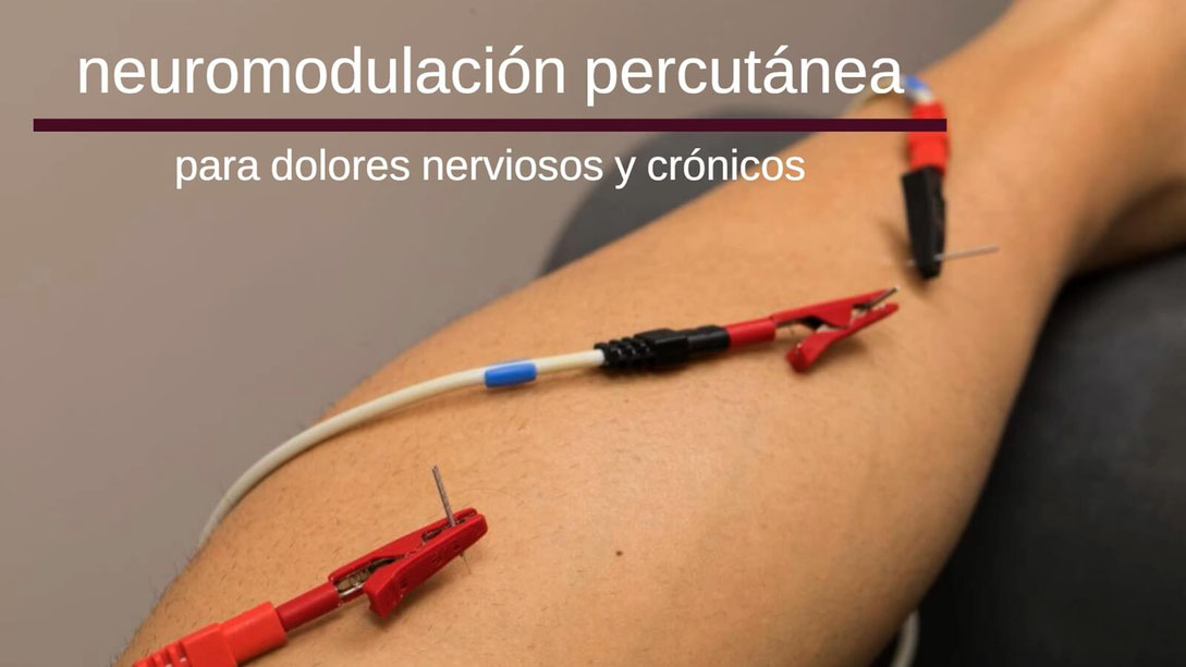 neuromodulacion madrid