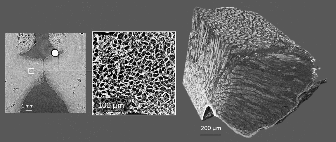 Multiscale X-ray tomographic images of a human vocal fold. Left: global view. Center: detail of the tissue. Right: 3D reconstruction of the network of muscular, collagen and elastic fibres (adapted from Bailly et al., in Scientific Reports, 2018)