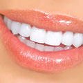 Bleaching, Zahnaufhellung, weiße Zähne, Veneers, weiße Füllungen, Keramik (© Kurhan - Fotolia.com)