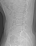Innere Werte für die Orthopäden unter euch.