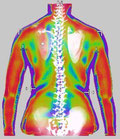 postura, schiena, simmetria spalle, scoliosi, paramorfismi della colonna, anca, scapole