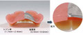 金属床入れ歯は保険の入れ歯よりも床の厚みが薄くなります