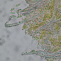 Flagelloscypha faginea-Randhare-Sporen