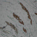 Clypeosphaeria mamillana-Asci-Sporen