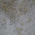 Anamorphe-Haplotrichum aureum-Konidien-Hyphen