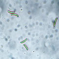 Cryptosphaeria eunomia Sporen