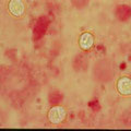 Cryptosporidien