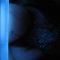 mitMicrosporum spp. befallene Haare fluoreszieren unter der Woodschen Lampe