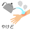 https://www.dermatol.or.jp/qa/qa8/index.html