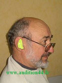 Empreinte de l'oreille