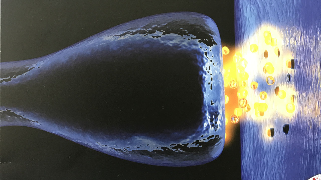 ASP - Alpha-Synapsen-Programmierung - Aurachirurgie