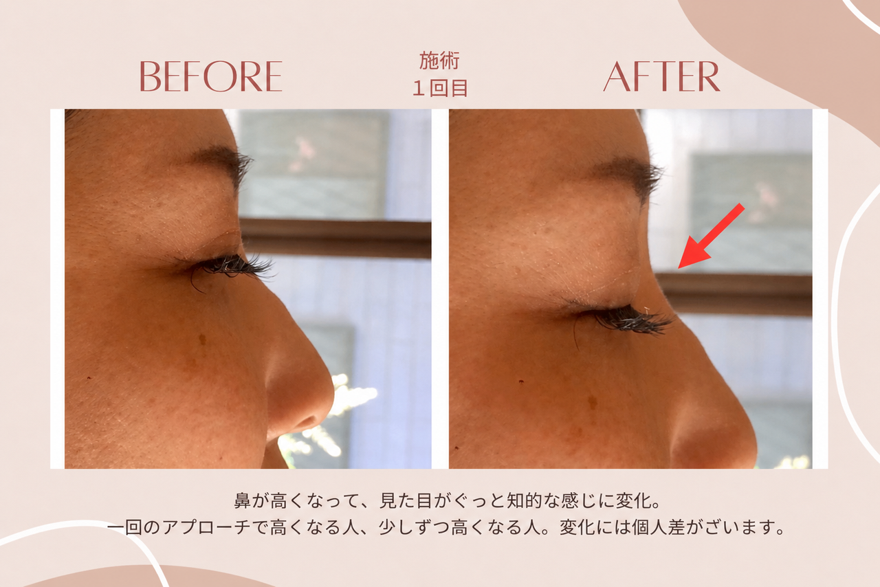 ハイエンド小顔イメージ