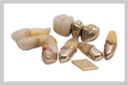 Zahngold verkaufen – exakte Analyse & faire Preise beim Goldankauf