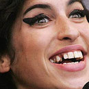 Amy Winehouse, ihre Leidensgeschichte kennen wir