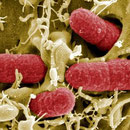 E Coli im Gedärm beim Wohlfühlen