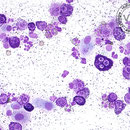 Mögliches Punktionsergebnis: Mastzelltumor