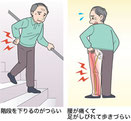 東京都豊島区池袋で鍼灸治療を脈診を中心に営んでいます。腰痛のは多く、様々の腰痛を鍼灸治療しました。腰痛の原因は主に冷えが原因です。その他、腰痛原因として怒り、打撲後遺症、過重もあります。手足が熱く肩コリを伴わない腰痛は要注意です。腰部の腫瘍等が原因かもしれません。足の冷えは腰痛には大敵です。坐骨神経痛、脊柱管狭窄症、慢性腰痛の方のほとんどの方が足の冷え伴います。坐骨神経痛、脊柱管狭窄症は痺れを伴います。冷えの解消する鍼灸治療が必要です。