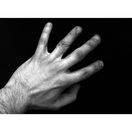 Mano maschile con cicatrici sulle dita - Foto di Francesca d'Amico - B&W