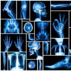 Risonanze Magnetiche, RM, RMN, Tac, TC, Moc, Mammografi, Telecomandati, Dr, Flat Panel, Usati