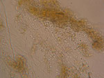 cauchi_bodo_dysfonctionnement_biologique_epuration_boue_activee_biomasse_assainissement_analyses_microscopiques_expertises_microbiologiques_bacterie_filament