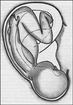 Projektion eines Embryos auf die Ohrmuschel