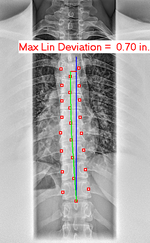 Max Linear Deviation