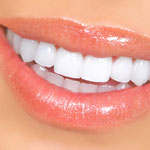 Bleaching, Zahnaufhellung, weiße Zähne, Veneers, weiße Füllungen, Keramik in Augsburg in Ihrer Nähe(© Kurhan - Fotolia.com)