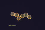Bild: Pollen Abutilon, Stack Mikroskop Auflicht