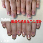 ネイルケアコース　綺麗な爪に生まれ変わりましょう。