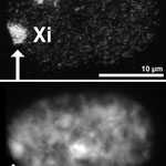 Das berühmte X-Chromosom