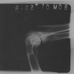 mediolateral gebeugte Haltung - linker Ellbogen