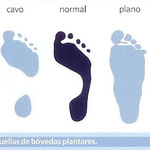 Pie Cavo de 2o grado,3er grado,pie plano